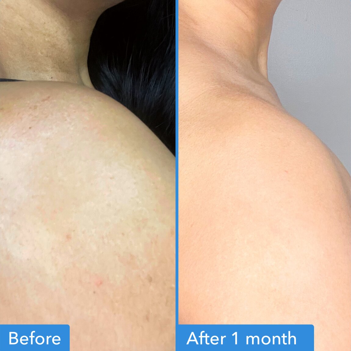 discoloration-correcting-body-treatment-m9 zb_p.jpg