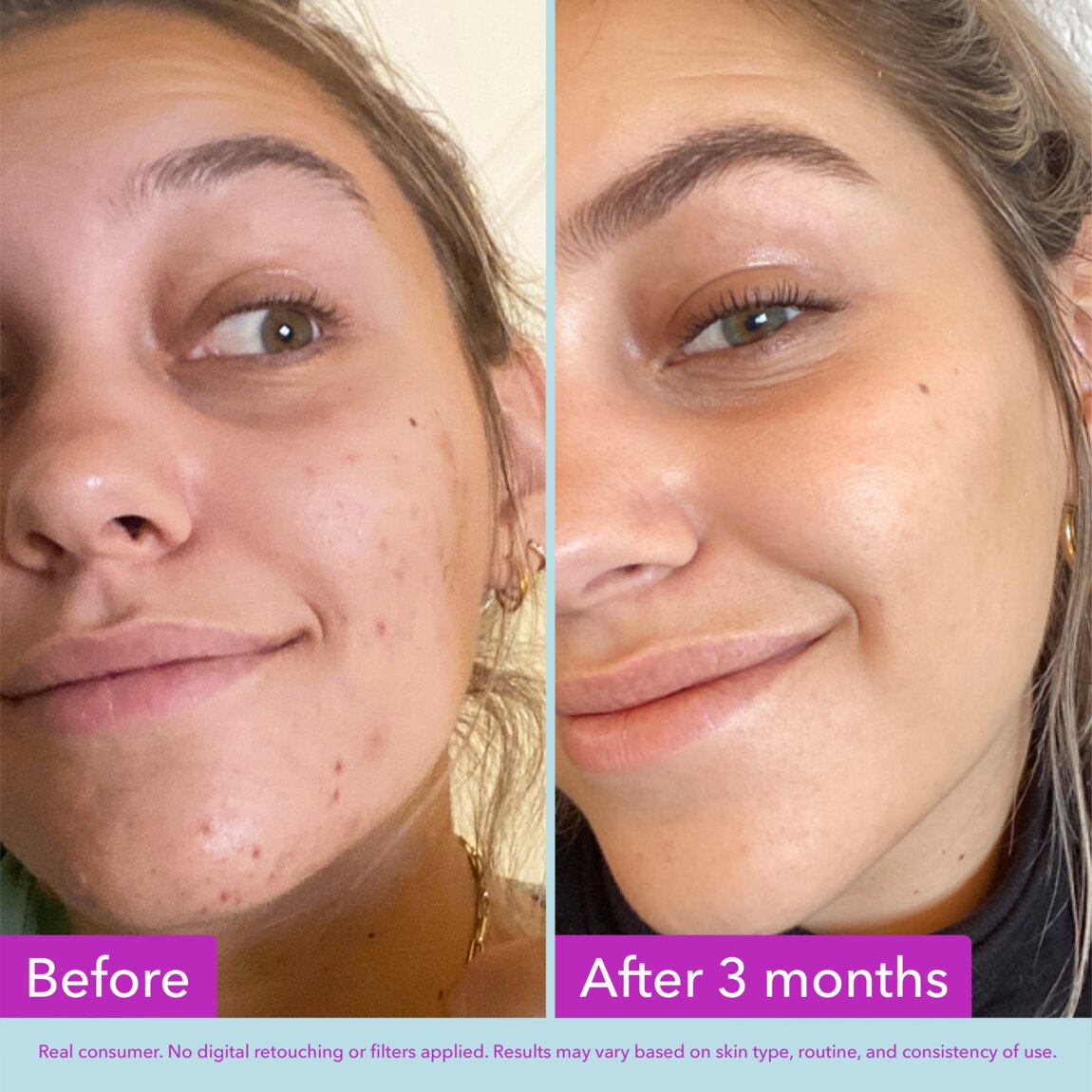 niacinamide-brightening-toner-f7 zb_p.jpg